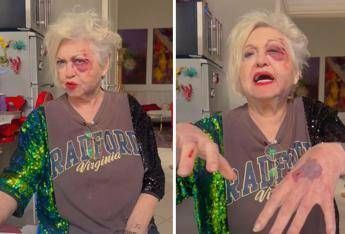 Wanna Marchi investita a Milano: "Sono devastata, ho rischiato la vita" Wanna Marchi investita a Milano: "Sono devastata, ho rischiato la vita"