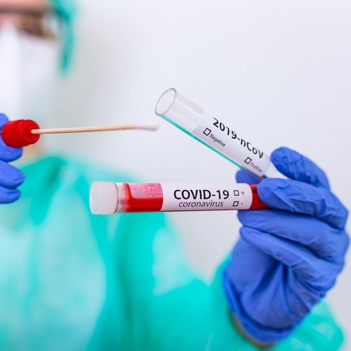 Canton Ticino; ieri 249 nuovi positivi al Covid, ma scende di 2 punti la percentuale di positività rapportata al numero dei tamponi eseguiti