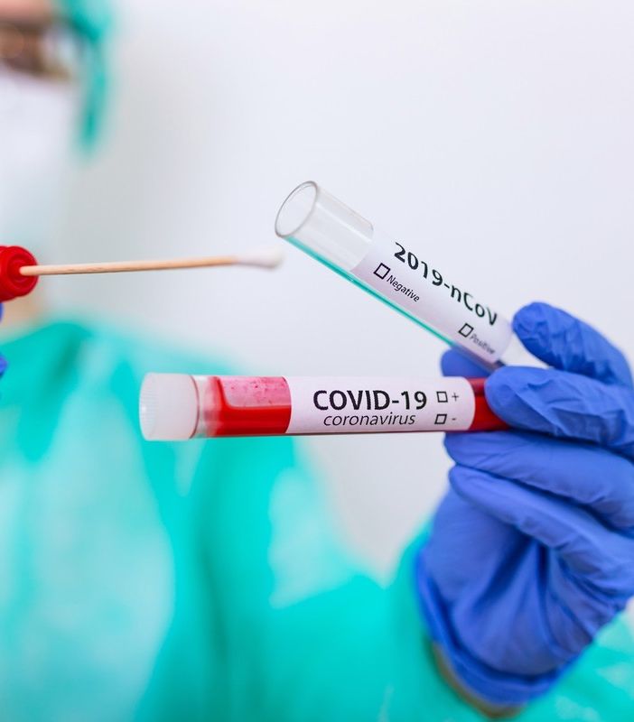 Canton Ticino; ieri 249 nuovi positivi al Covid, ma scende di 2 punti la percentuale di positività rapportata al numero dei tamponi eseguiti