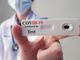 In Ticino test sierologico offerto, ma se ci si vaccina