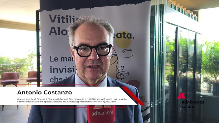 Farmaci: Costanzo (Sidemast), 'attendiamo ok Aifa per nuova cura per vitiligine e alopecia'