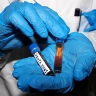 Hantavirus, test negativo per la persona in isolamento in Veneto Hantavirus, test negativo per la persona in isolamento in Veneto