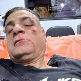 Cicalone, lo youtuber aggredito in metro a Roma: &quot;Infami veri&quot;