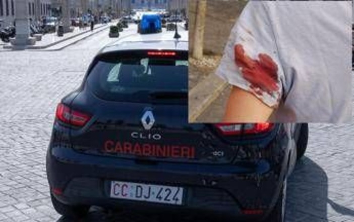 Spari con arma ad aria compressa in centro a Roma, la donna colpita: "Mi hanno detto che si ripetono da giorni" Spari con arma ad aria compressa in centro a Roma, la donna colpita: "Mi hanno detto che si ripetono da giorni"