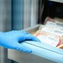 Leucemia mieloide cronica, asciminib conferma efficacia e sicurezza a 3 anni