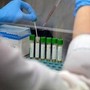 Mers, 9 casi con due morti in Arabia Saudita. Oms: &quot;Rischio moderato&quot;