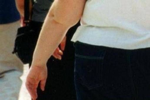 Una morte per malattie infettive su 10 è legata all'obesità, lo studio