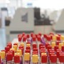 Malaria in aeroporto in Germania, gli esperti: "Campanello d'allarme, ma il rischio resta contenuto" Malaria in aeroporto in Germania, gli esperti: "Campanello d'allarme, ma il rischio resta contenuto"