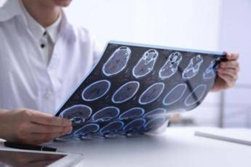 Giornata Sla, neurologi: &quot;Non resti confinata alla sperimentazione&quot;