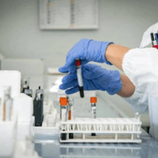 Hantavirus, 4 persone monitorate in Italia: "Non hanno sintomi" Hantavirus, 4 persone monitorate in Italia: "Non hanno sintomi"