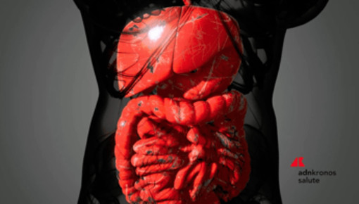 Malattia di Crohn, solo 1 paziente su 3 riceve supporto nutrizionale