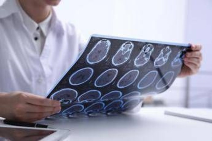 Giornata Sla, neurologi: &quot;Non resti confinata alla sperimentazione&quot;