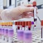 Dengue, un caso autoctono in Veneto. Salgono a 73 i casi di West Nile nel Lazio