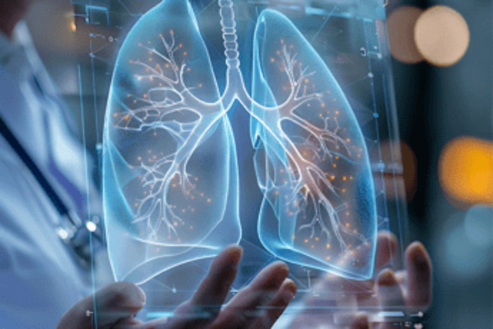 Cancro aggressivo al polmone, con mix di farmaci biologici raddoppia efficacia senza chemio