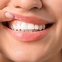 Denti a rischio tra i giovani, Sidp: "Il 36% della Gen Z ha gengive che sanguinano" Denti a rischio tra i giovani, Sidp: "Il 36% della Gen Z ha gengive che sanguinano"