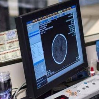 Salute, Padovani (Sin): &quot;Longevità aumenta rischio Alzheimer, agire su prevenzione&quot;