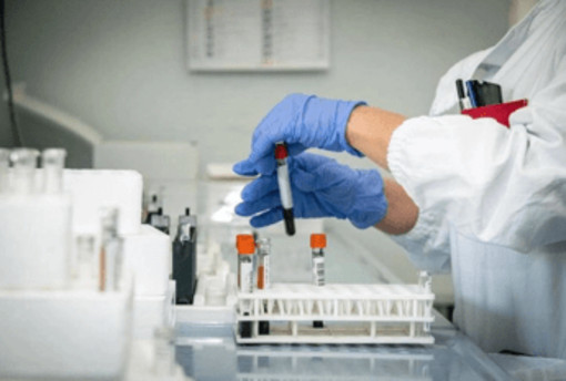 Hantavirus, 4 persone monitorate in Italia: "Non hanno sintomi" Hantavirus, 4 persone monitorate in Italia: "Non hanno sintomi"