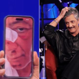 Fiorello, l'incidente in bicicletta: &quot;Volevo fare il figo... sono caduto di faccia&quot;