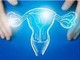 Cancro endometrio avanzato, nuove terapie migliorano sopravvivenza
