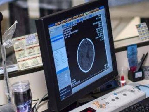 Salute, Padovani (Sin): &quot;Longevità aumenta rischio Alzheimer, agire su prevenzione&quot;