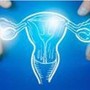 Cancro endometrio avanzato, nuove terapie migliorano sopravvivenza