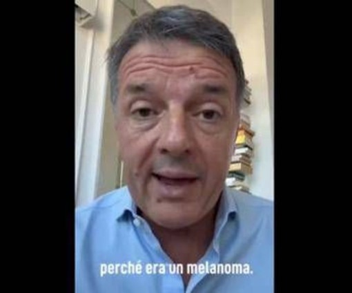 Renzi e il melanoma: "L'ho rimosso, nessun rischio per me ma bisogna controllarsi"