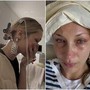 Bella Hadid, lacrime e flebo: le foto che preoccupano i fan