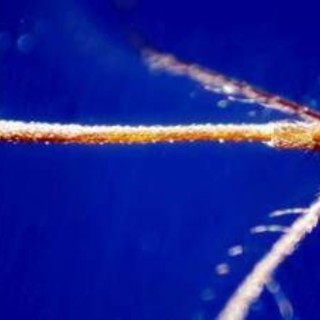 West Nile, casi nel Lazio &quot;solo la punta dell'iceberg&quot;: oggi vertice degli infettivologi