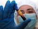 Hantavirus, negativo il turista inglese in quarantena a Milano. Test per una donna ricoverata a Messina Hantavirus, negativo il turista inglese in quarantena a Milano. Test per una donna ricoverata a Messina