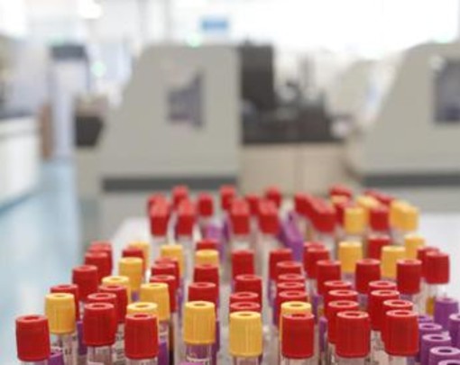 Malaria in aeroporto in Germania, gli esperti: "Campanello d'allarme, ma il rischio resta contenuto" Malaria in aeroporto in Germania, gli esperti: "Campanello d'allarme, ma il rischio resta contenuto"