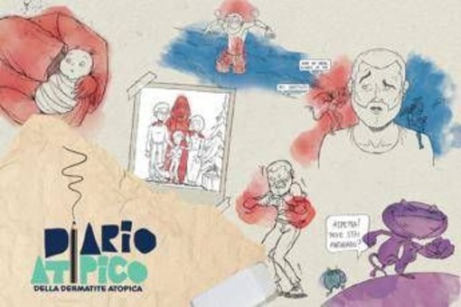 Dermatite atopica, oltre 1,3 mln di persone hanno visto il corto 'Diario atipico'