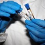 Hantavirus, Ema monitora diffusione: "Pronti a supportare iter vaccini" Hantavirus, Ema monitora diffusione: "Pronti a supportare iter vaccini"